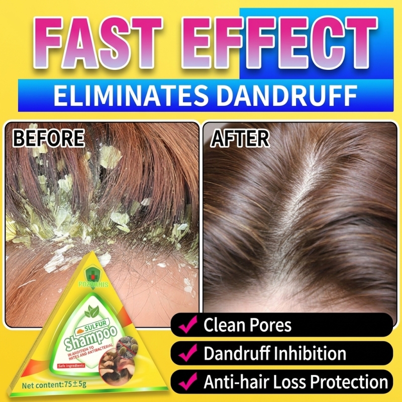 Severe Thinning Hair Awakener  - Hair Care Dandruff 评论和价格